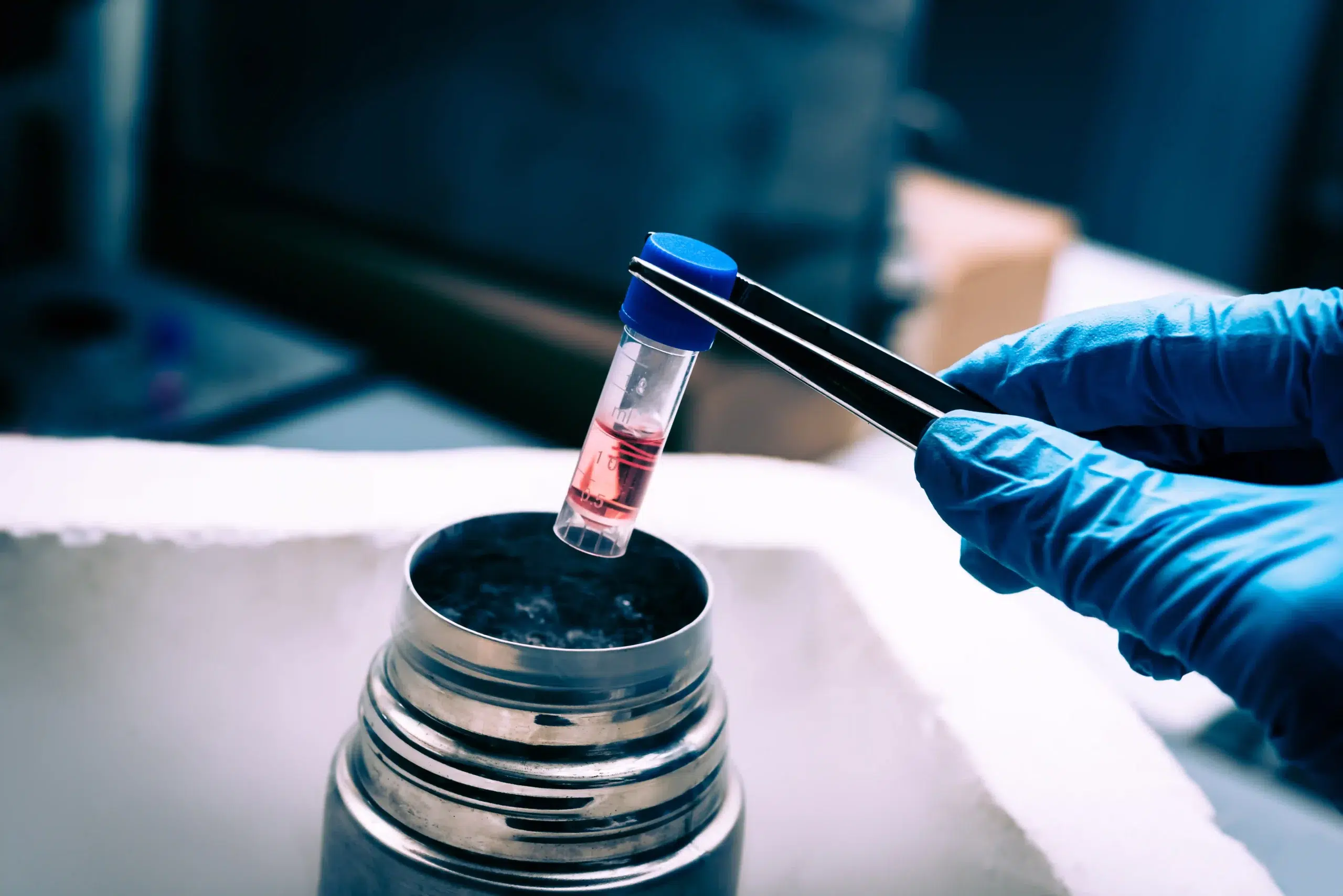 A gloved laboratory hand using forceps to carefully handle a cryogenic vial containing stem cells for therapy in Malaysia.